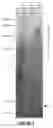 Fig. 08 - High molecular weight heparosan polymers and methods of production and use thereof