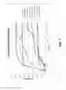 Fig. 07 - Method of forming golf club head assembly
