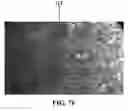 Fig. 22 - In-situ microbubbles generation for ultrasonic biomedical applications