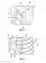 Fig. 05 - Spring retaining assembly for vehicle latch actuator mechanism