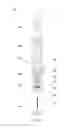 Fig. 07 - Check valve, associated downhole data collection system and inner core barrel assembly