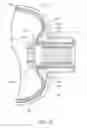 Fig. 08 - Boss assembly for composite cylinder