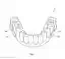Fig. 02 - Methods to quantify an ion in a dental biofilm
