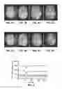 Fig. 04 - Multi-echo spin-, asymmetric spin-, and gradient-echo echo-planar imaging MRI pulse sequence