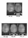 Fig. 06 - Multi-echo spin-, asymmetric spin-, and gradient-echo echo-planar imaging MRI pulse sequence