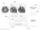 Fig. 01 - Predicting cancer progression using cell run length features