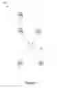 Fig. 11 - Decomposition of a video stream into salient fragments