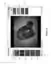 Fig. 08 - Automatically assessing an anatomical surface feature and securely managing information related to the same