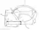 Fig. 01 - Strap arm of head-mounted display with integrated audio port