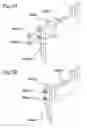 Fig. 08 - Method of mounting component