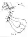 Fig. 19 - Polyfunctional Tool