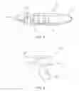 Fig. 02 - DEVICE AND METHOD FOR CLEANING AQUARIUMS