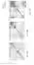 Fig. 27 - Delivery, use and therapeutic applications of the CRISPR-cas systems and compositions for modeling mutations in leukocytes