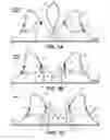 Fig. 02 - Pumping/nursing bra
