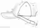 Fig. 01 - CONVERTIBLE CAP THAT CONVERTS INTO A VISOR