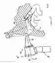 Fig. 03 - OTOSCOPE