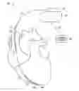 Fig. 01 - Post-hoc atrial fibrillation detection