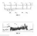 Fig. 07 - Post-hoc atrial fibrillation detection