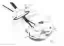 Fig. 01 - Pneumoperitoneum device