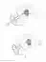 Fig. 35 - Pneumoperitoneum device