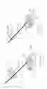 Fig. 45 - Pneumoperitoneum device