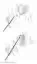 Fig. 46 - Pneumoperitoneum device