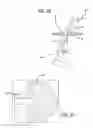 Fig. 10 - Anchor delivery system