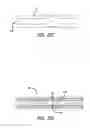 Fig. 28 - Anchor delivery system