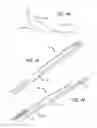 Fig. 37 - Anchor delivery system