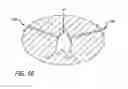 Fig. 45 - Anchor delivery system