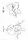 Fig. 02 - Balloon with shape control for spinal procedures