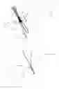 Fig. 02 - BONE SUTURE ASSEMBLY