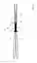 Fig. 06 - BONE SUTURE ASSEMBLY