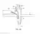Fig. 22 - Methods and devices for knotless suture anchoring