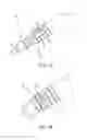 Fig. 02 - Methods and systems for knotless suture anchoring