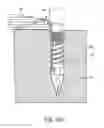 Fig. 26 - Methods and devices for knotless suture anchoring