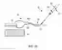 Fig. 32 - Methods and devices for knotless suture anchoring