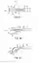 Fig. 06 - Methods and devices for creating tissue plications