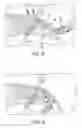 Fig. 04 - Method for knotless fixation of tissue