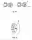 Fig. 06 - Method for knotless fixation of tissue