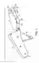 Fig. 02 - Methods of surgical fastening