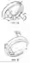 Fig. 07 - Methods of surgical fastening