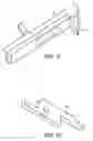 Fig. 09 - Methods of surgical fastening