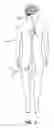 Fig. 02 - Systems and methods for delivering intravascular implants