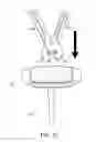Fig. 17 - Handles for needle assemblies