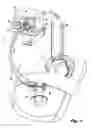 Fig. 02 - Separable two-part single lumen gas sealed access port for use during endoscopic surgical procedures