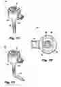 Fig. 09 - Separable two-part single lumen gas sealed access port for use during endoscopic surgical procedures