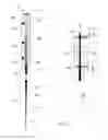 Fig. 08 - MONOPOLAR AND BIPOLAR ELECTROSURGERY DEVICE