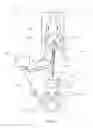 Fig. 02 - Electrosurgery device