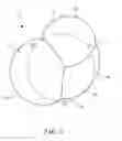 Fig. 02 - Multi-chambered breast tissue expander